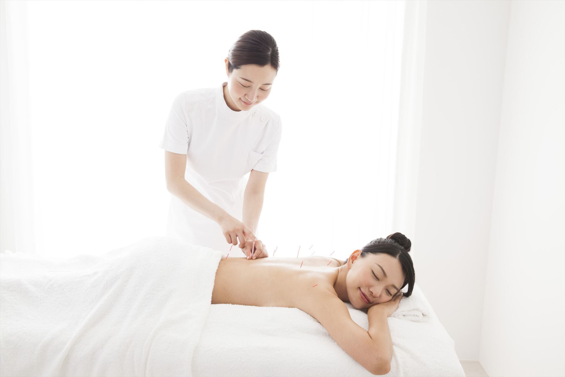背中に鍼を打つ女性スタッフ